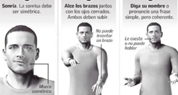 Información útil: Mira cómo detectar un ACV o derrame cerebral en segundos