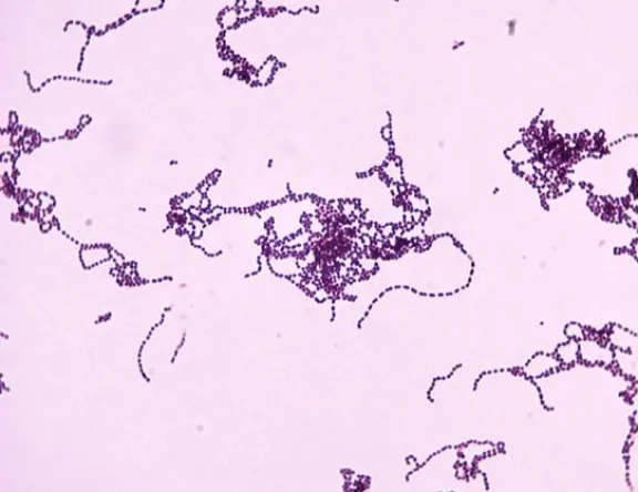La “Bacteria asesina” en Chile: Conoce qué es, los efectos y cómo prevenir los contagios