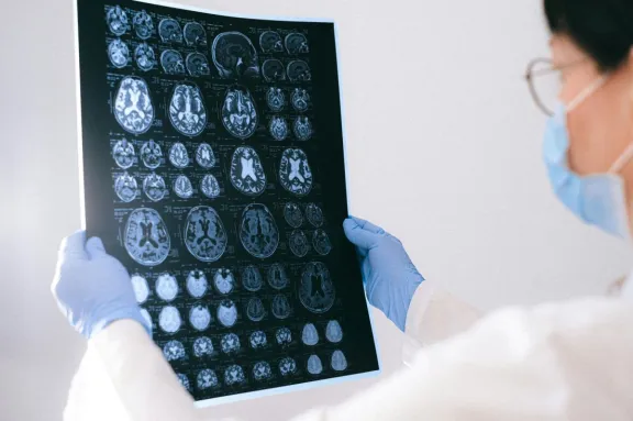 Los cuatro hábitos que deterioran tu cerebro: Uno eleva el riesgo de demencia